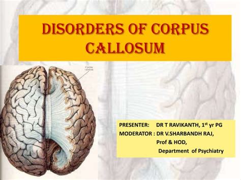 Disorders of corpus callosum | PPT