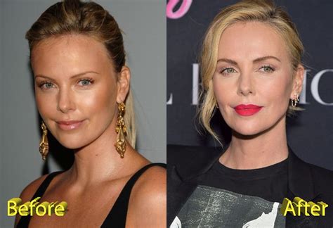 Charlize Theron Plastic Surgery Rumors Sparked By Tully and Gringo