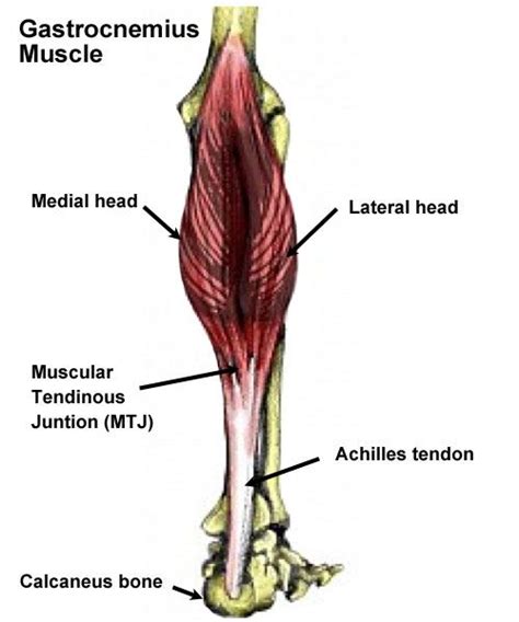 The 25+ best Gastrocnemius tear ideas on Pinterest | Calf muscle strain, Calf muscle tear and ...