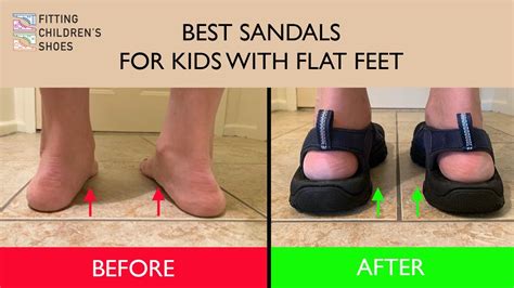 Best Sandals for Flat Feet: Ultimate Comfort Picks! | ipallshealthcare.com