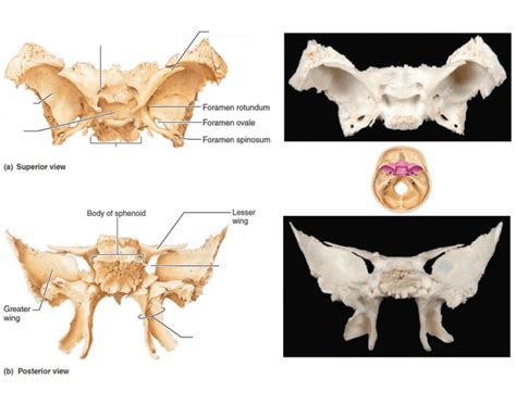 Sphenoid Bone Markings (Landmarks) Quiz