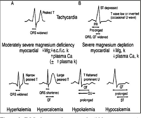 Figure 2 from Hypomagnesemia and cardiovascular system. | Semantic Scholar