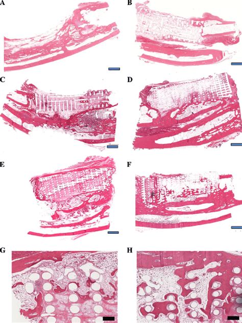 H&E staining of histological sections formed by implantation of a no ...