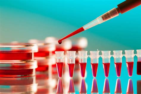 What does it mean when serum iron is high but ferritin is low? - Dr ...