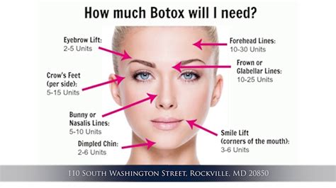 Basics of Botox Injection - YouTube