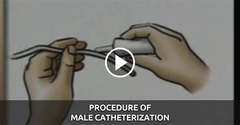 Procedure of Male Catheterization - QD Nurses