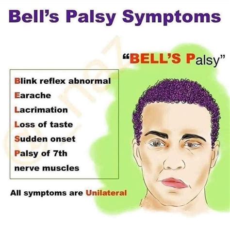 Pin by Brandie Garcia on Nursing | Bells palsy, Bell's palsy symptoms, Nurse