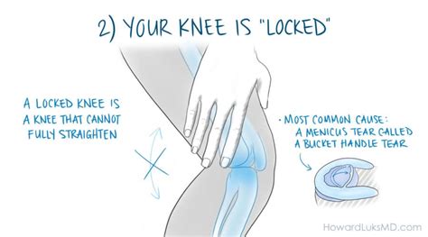 Is My Knee Injury Serious? 5 Signs to Look For.