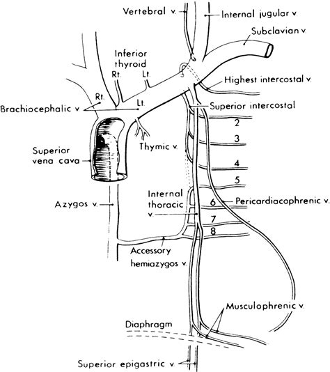 Pedi cardiology: Innominate vein tributories