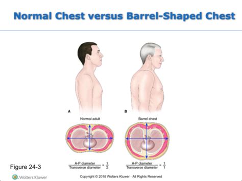 Chapter 24: Management of Patients With Chronic Pulmonary Disease Flashcards | Quizlet