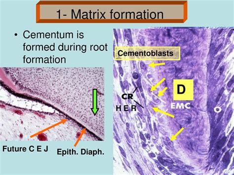 Cementum. - ppt download