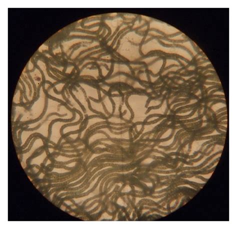 The sample of live spirulina under microscope (a) and in incubator (b ...