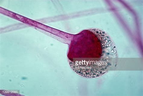 Rhizopus, black bread mold, sporangium with spores & sporangiophore ...