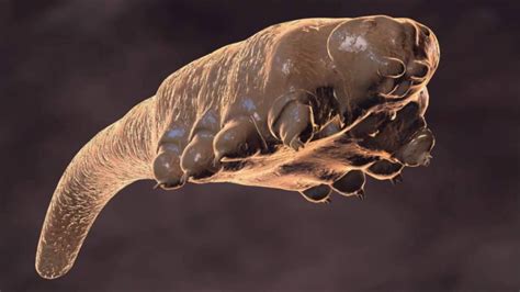 What Are Demodex Mites? Face Mite, Hair Mite | UNGEX | Demodex, Demodex mites, Mites