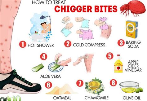 Chigger Bites - Pictures, Treatment, Look Like, Home Remedies