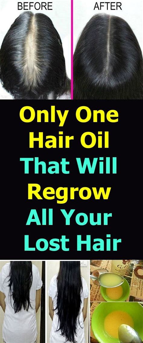 How Can I Regrow My Hair Naturally Tips And Tricks - The Definitive Guide to Men's Hairstyles