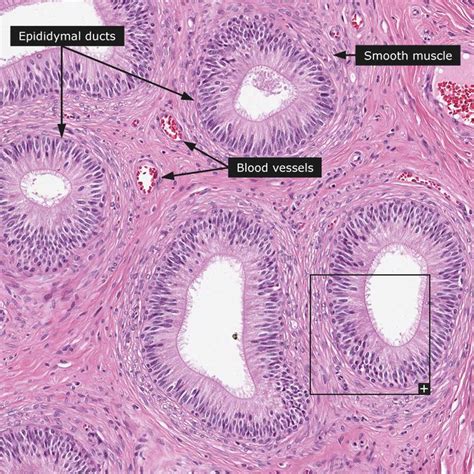 Dictionary - Normal: Epididymis | Human anatomy and physiology, Medical studies, Medical school ...