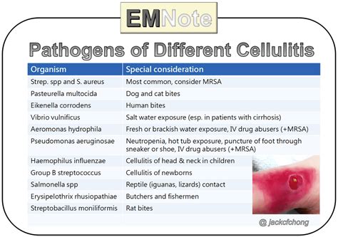 Cellulitis Causes