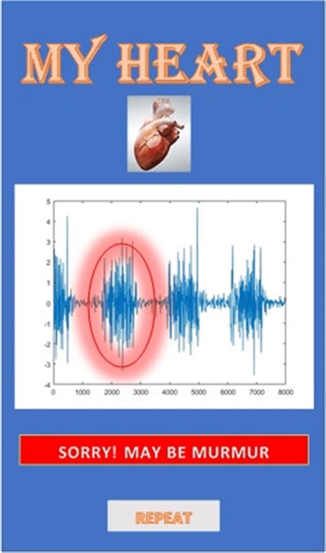 MY HEART result for heart sounds with murmur | Download Scientific Diagram