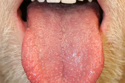 Bumps on the Tongue: What It Could Mean | Reader's Digest