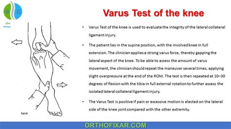 Varus Test Of The Knee | OrthoFixar 2024