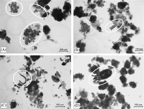 Examples of protozoa and metazoa forming a stable population in the SBR ...