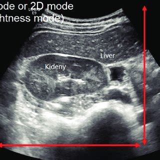 Ultrasound basic physics | Download Scientific Diagram