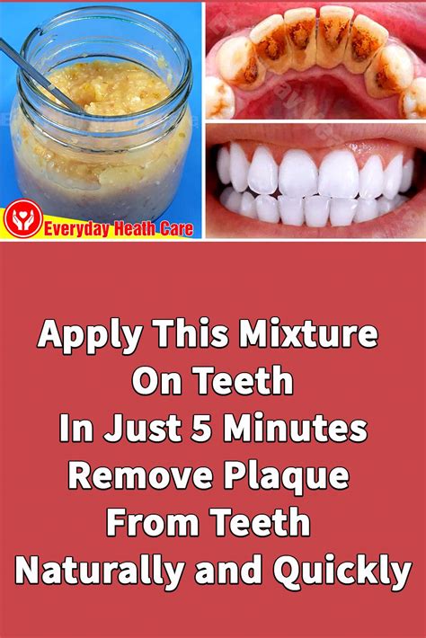 Apply This Mixture On Teeth || In Just 5 Minutes, Remove Plaque From Teeth Naturally and Quickly