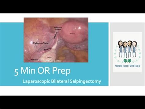 5 min Operating Room Prep - Successful Laparoscopic Bilateral ...