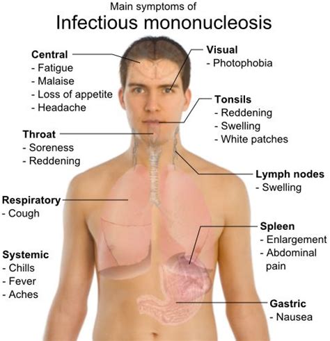 Mononucleosis - avoid direct contact with others and take antiviral herbal remedies to fight.