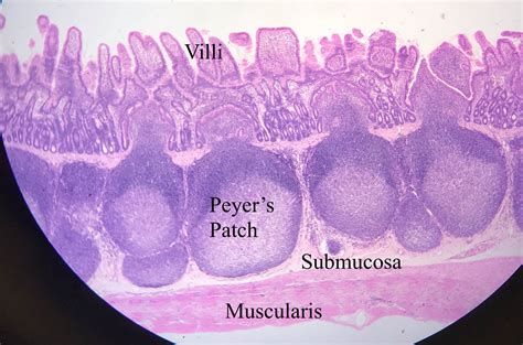 Ileum Histology.