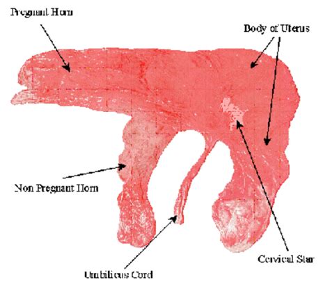 Benefits Of Eating Placenta Can Increase Breast Milk