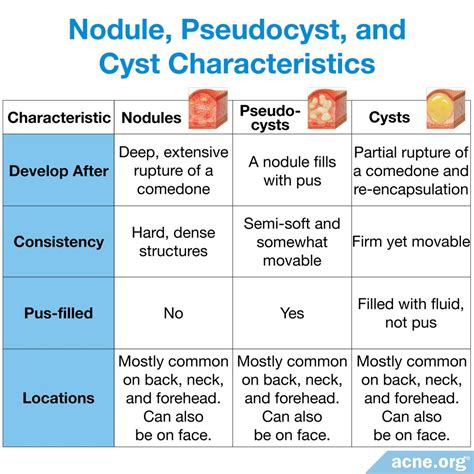 Cystic Acne on the Body - Acne.org