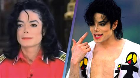 Michael Jackson explained his skin disorder after claims he was bleaching it to become white ...