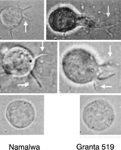 Pseudopodia formation in Namalwa (left panels) and Granta 519 (right... | Download Scientific ...