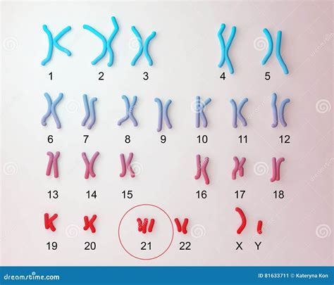 Down-syndrome Karyotype Royalty-Free Illustration | CartoonDealer.com #81633711