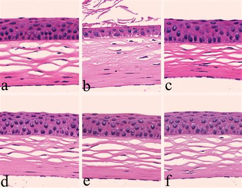 corneal epithelium - meddic