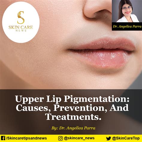 Upper Lip Pigmentation: Causes, Prevention, And Treatments.