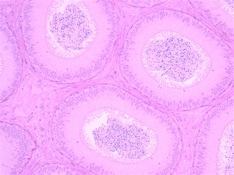 Testis Epididymis Histology