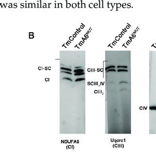 OXPHOS complex and supercomplex assembly analysis: (A) pattern of ...