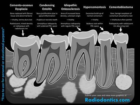 Periapical Radiolucency