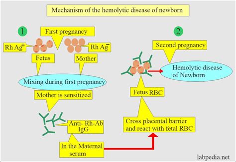 Hemolytic disease of newborn (HDN), and coombs test