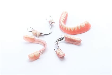 Dental Bridges Vs. Partial Dentures