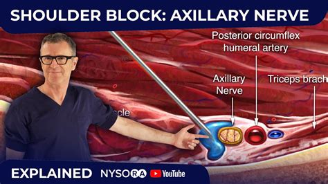 Shoulder Block: Axillary Nerve - YouTube