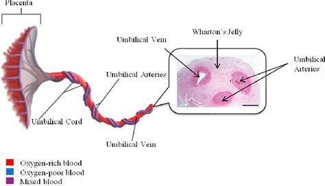 Cord Blood Stem Cell Transplant - Hematopoietic Stem Cell Transplantation Wikipedia / Cord blood ...