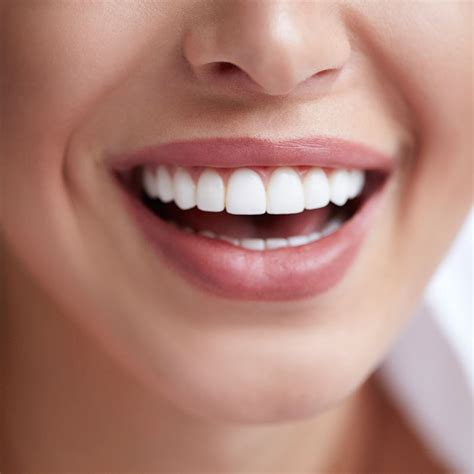 Porcelain Veneers – Australian Dental Specialists