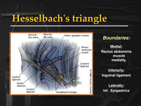 PPT - Inguinal Hernias PowerPoint Presentation, free download - ID:218475