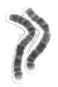 Chromosome 2 - Wikipedia