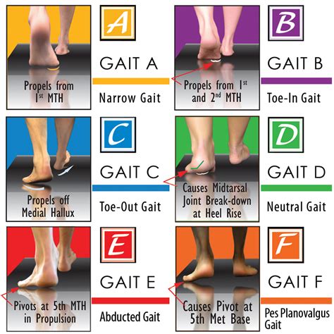 Attaining Successful Orthotic Outcomes through Functional Foot Typing ...