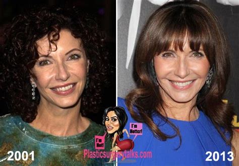 Mary Steenburgen Plastic Surgery Before & After - Plastic Surgery Talks